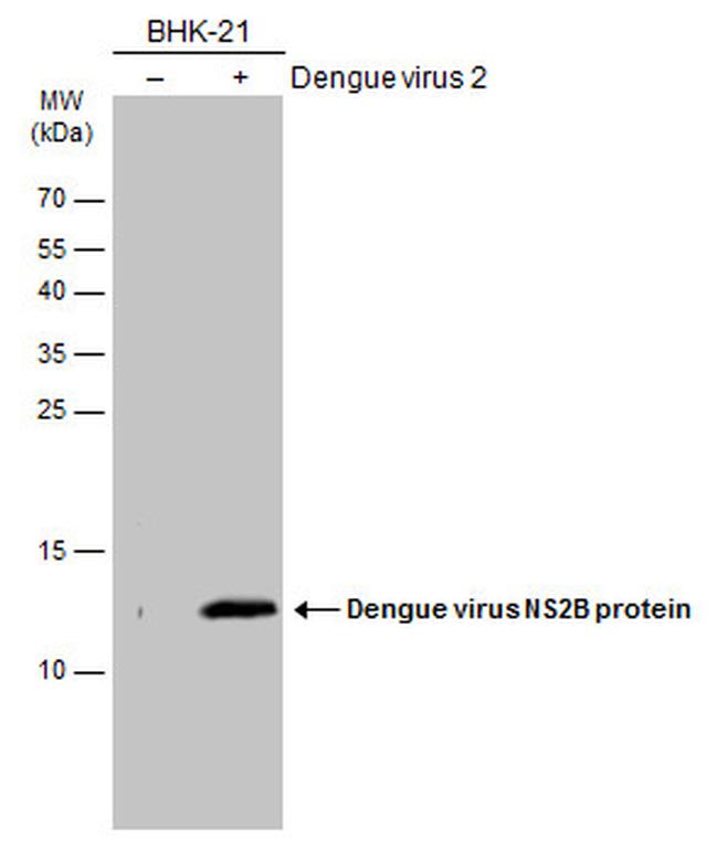 Dengue Virus Type 2 NS2B Antibody in Western Blot (WB)