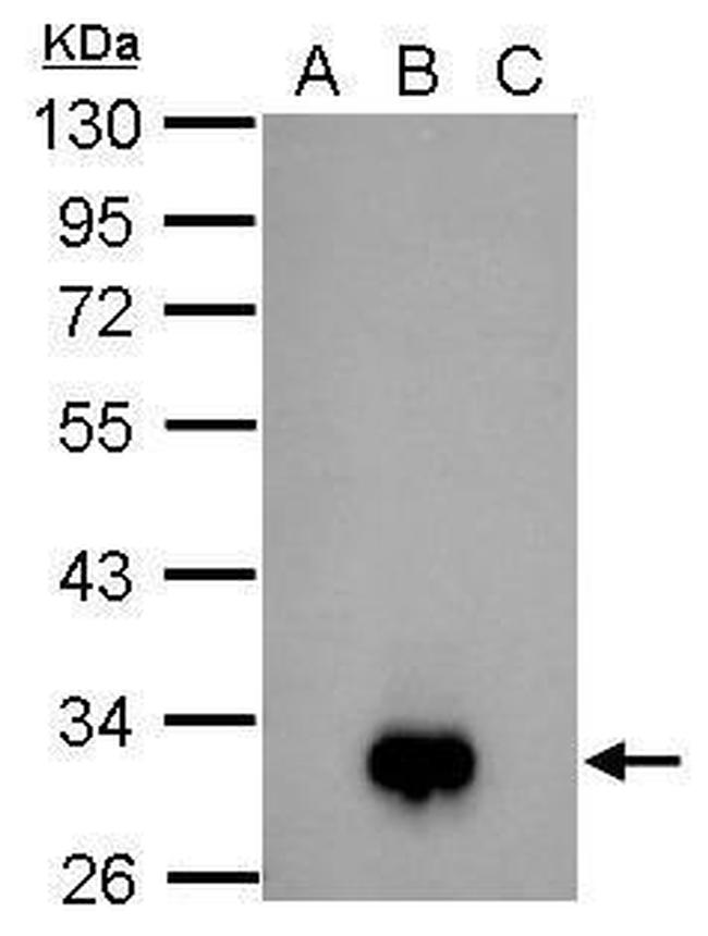 Dengue Virus Type 2 NS4B Antibody in Western Blot (WB)