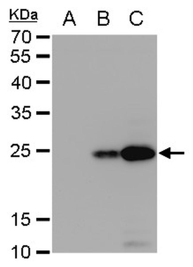 Dengue Virus Type 2 NS4B Antibody in Western Blot (WB)