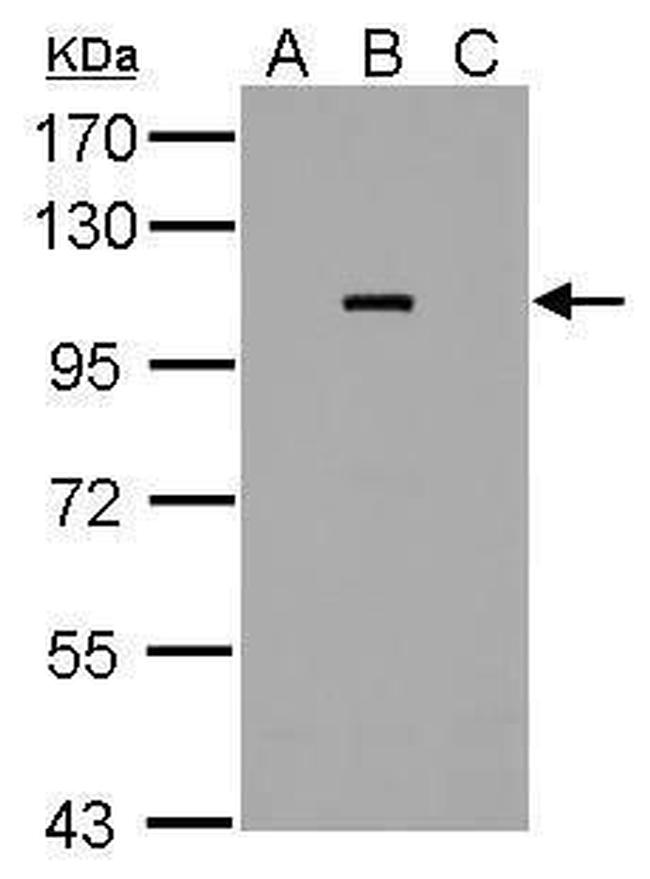 Dengue Virus Type 2 NS5 Antibody in Western Blot (WB)