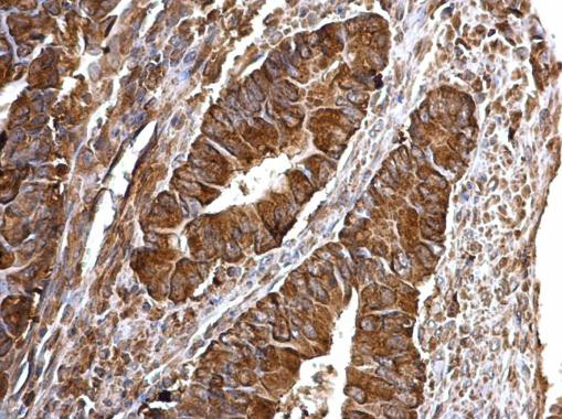 Bcl-xS Antibody in Immunohistochemistry (Paraffin) (IHC (P))