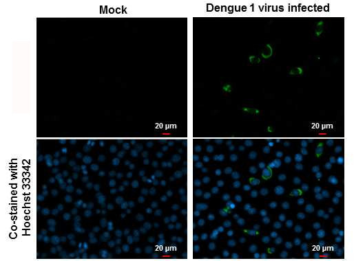 Dengue Virus Type 2 NS1 Antibody in Immunocytochemistry (ICC/IF)