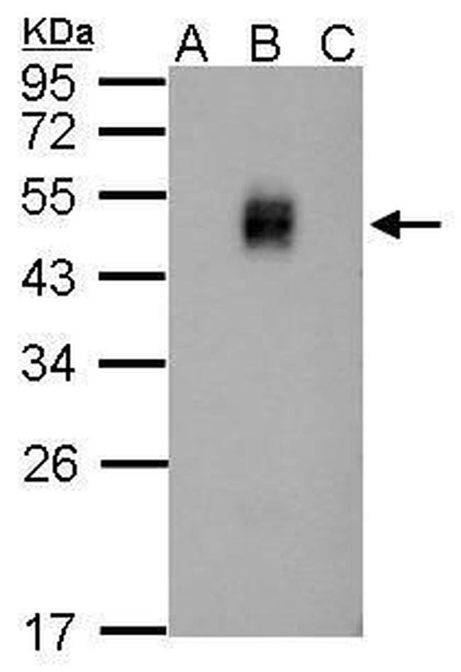 Dengue Virus Type 2 NS1 Antibody in Western Blot (WB)