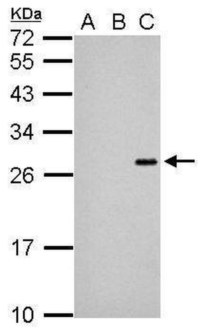 Japanese Encephalitis Virus NS4B Antibody in Western Blot (WB)