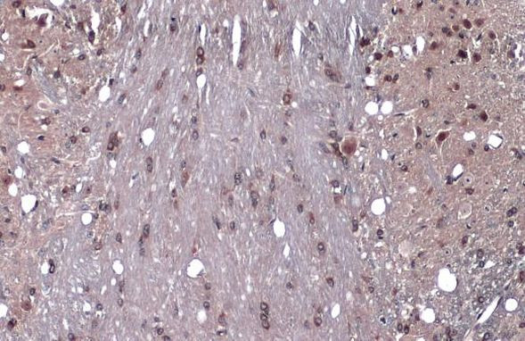 GEF-H1 Antibody in Immunohistochemistry (Paraffin) (IHC (P))