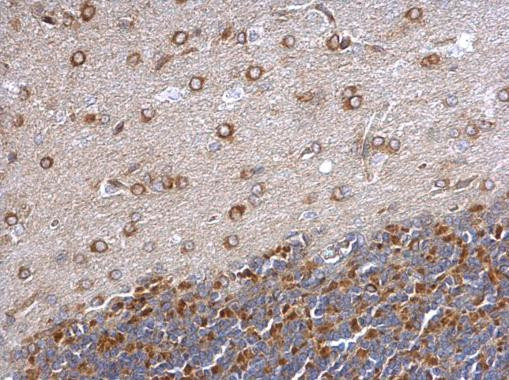 GEF-H1 Antibody in Immunohistochemistry (Paraffin) (IHC (P))