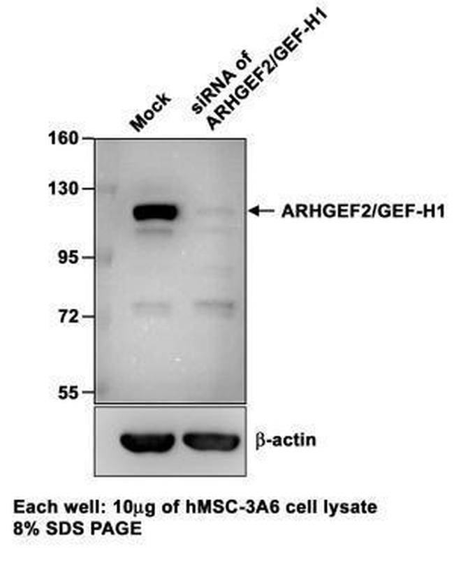 GEF-H1 Antibody in Western Blot (WB)