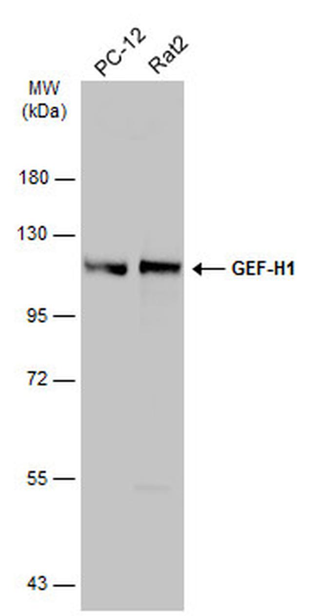 GEF-H1 Antibody in Western Blot (WB)