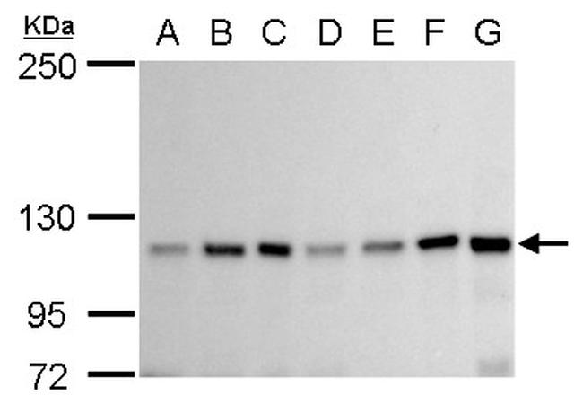 GEF-H1 Antibody in Western Blot (WB)