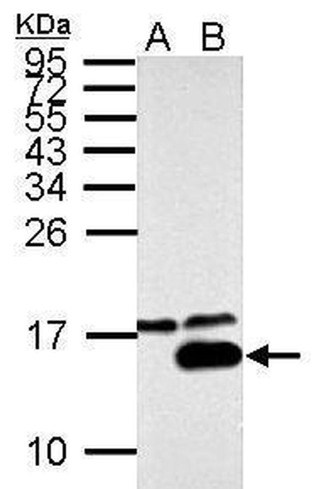 Galectin 7 Antibody in Western Blot (WB)