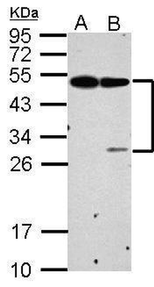 EPCR Antibody in Western Blot (WB)