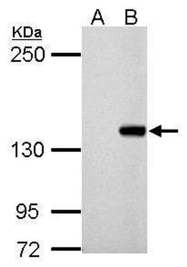 DNMT3B Antibody in Western Blot (WB)