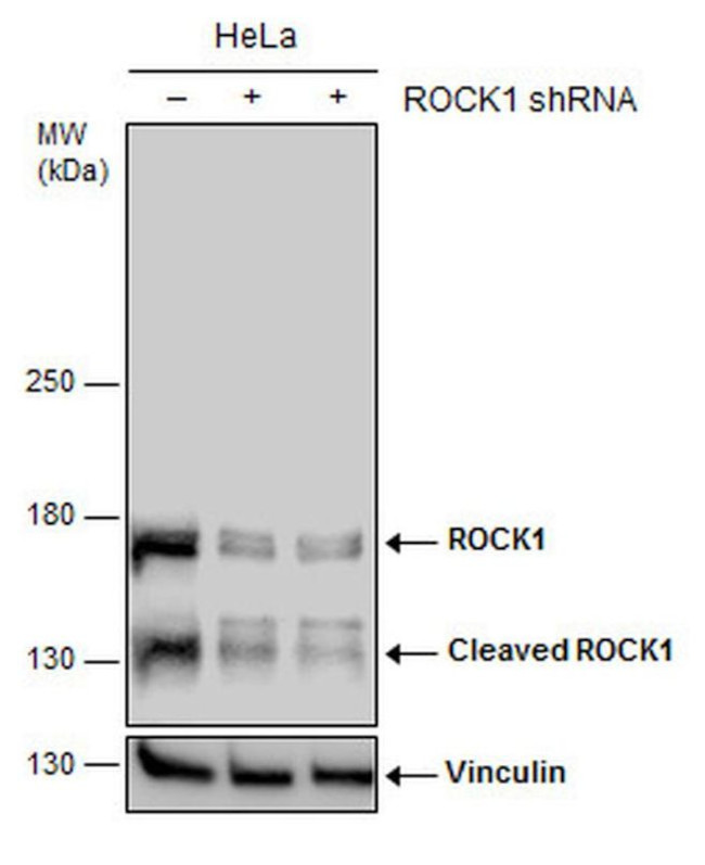 ROCK1 Antibody