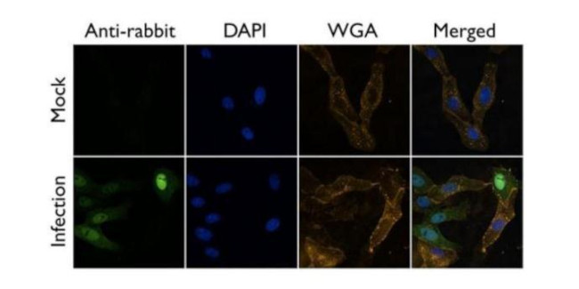 Influenza A PA Antibody in Immunocytochemistry (ICC/IF)