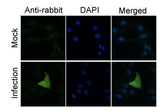 Influenza A PA Antibody in Immunocytochemistry (ICC/IF)