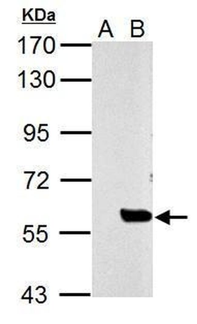 SLU7 Antibody in Western Blot (WB)