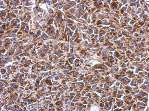 SHMT2 Antibody in Immunohistochemistry (Paraffin) (IHC (P))