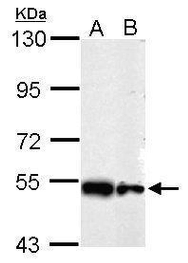 SHMT2 Antibody in Western Blot (WB)