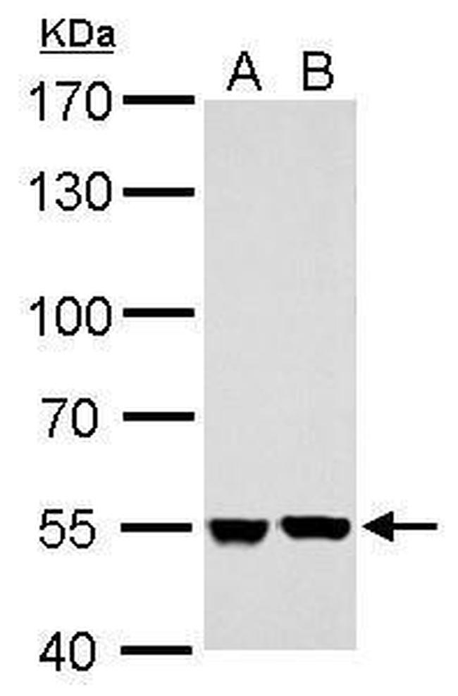 SHMT2 Antibody in Western Blot (WB)