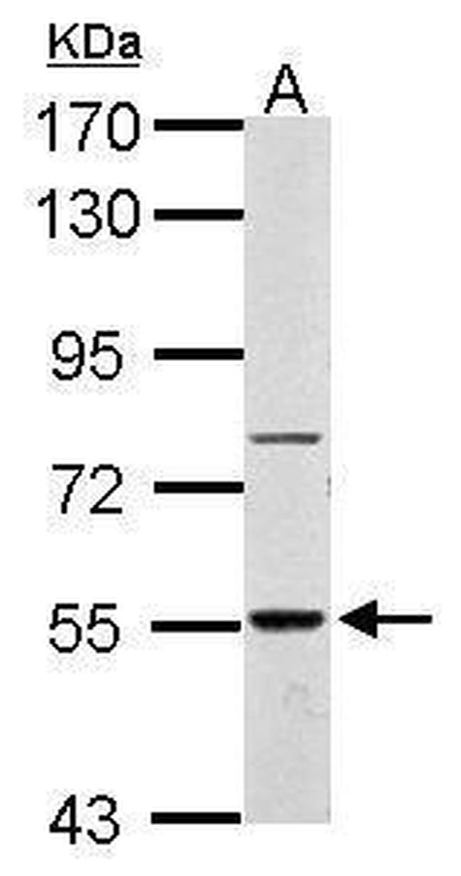 RAD26L Antibody in Western Blot (WB)