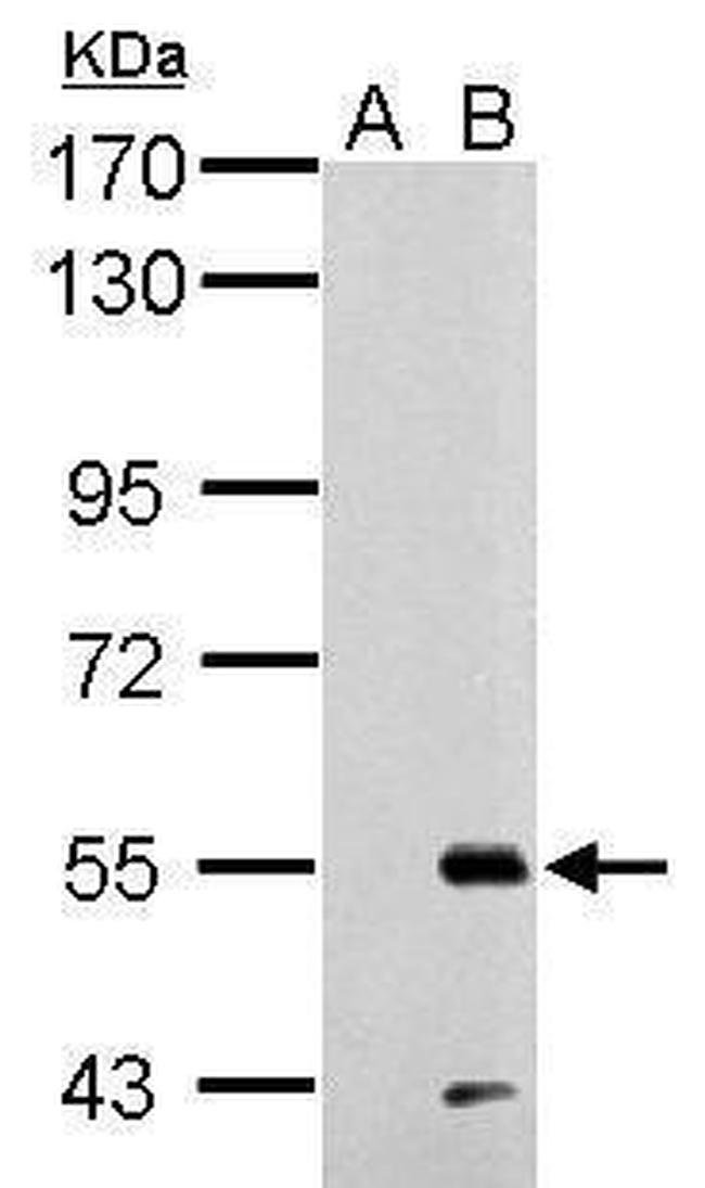 RAD26L Antibody in Western Blot (WB)