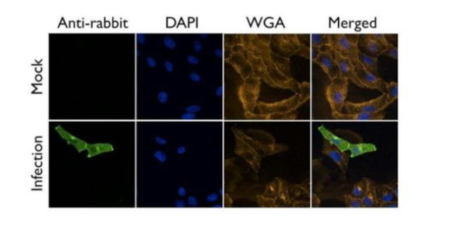 Influenza A M2 Antibody in Immunocytochemistry (ICC/IF)