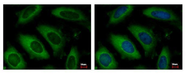 ARD1A Antibody in Immunocytochemistry (ICC/IF)