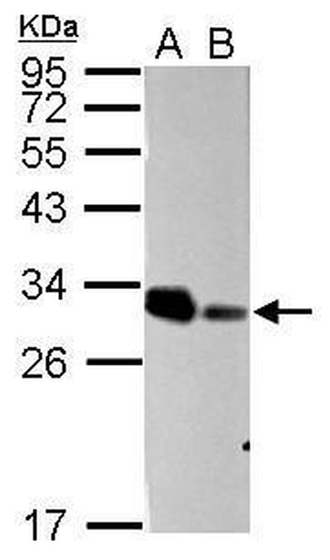 ARD1A Antibody in Western Blot (WB)