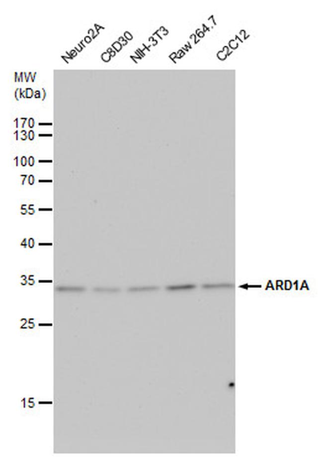 ARD1A Antibody in Western Blot (WB)