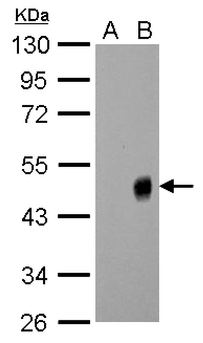 Influenza A H1N1 NA Antibody in Western Blot (WB)