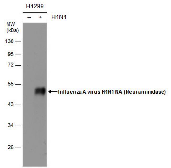 Influenza A H1N1 NA Antibody in Western Blot (WB)