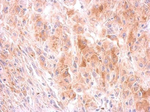 GRB10 Antibody in Immunohistochemistry (Paraffin) (IHC (P))