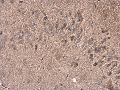 GABA Antibody in Immunohistochemistry (Paraffin) (IHC (P))