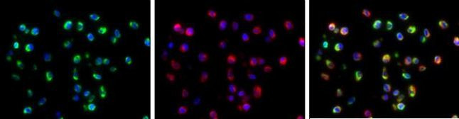 Dengue Virus Type 2 Envelope Antibody in Immunocytochemistry (ICC/IF)