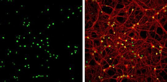 HMGB1 Antibody in Immunocytochemistry (ICC/IF)