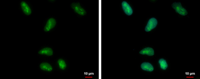 HMGB1 Antibody in Immunocytochemistry (ICC/IF)