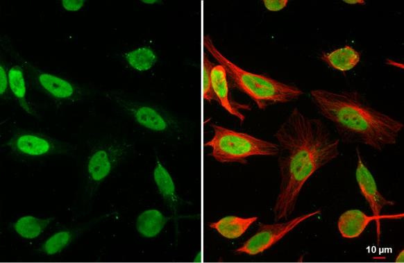 HMGB1 Antibody in Immunocytochemistry (ICC/IF)