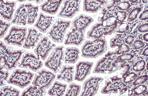 HMGB1 Antibody in Immunohistochemistry (Paraffin) (IHC (P))