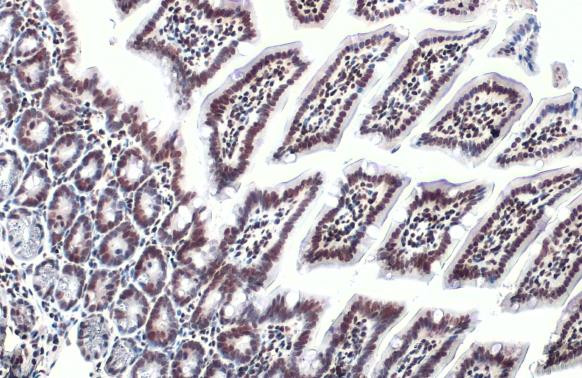 HMGB1 Antibody in Immunohistochemistry (Paraffin) (IHC (P))