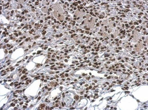 HMGB1 Antibody in Immunohistochemistry (Paraffin) (IHC (P))