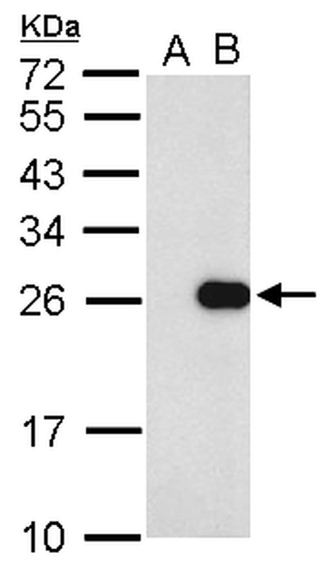 Influenza A M1 Antibody in Western Blot (WB)