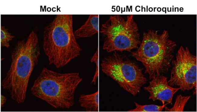 LC3B Antibody in Immunocytochemistry (ICC/IF)