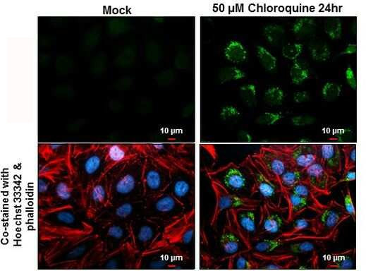 LC3B Antibody in Immunocytochemistry (ICC/IF)