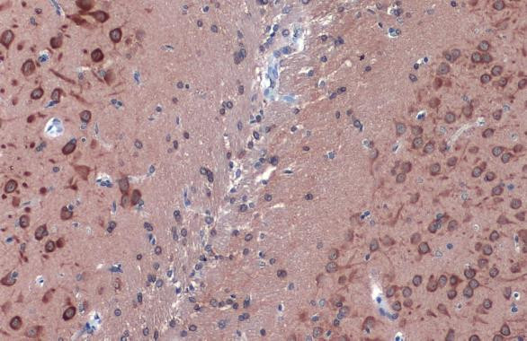 LC3B Antibody in Immunohistochemistry (Paraffin) (IHC (P))