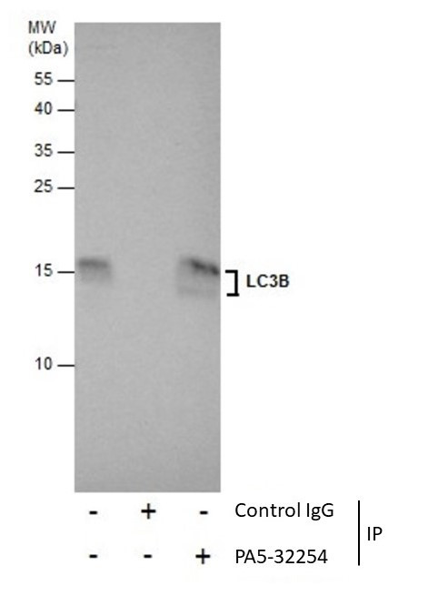 LC3B Antibody in Immunoprecipitation (IP)