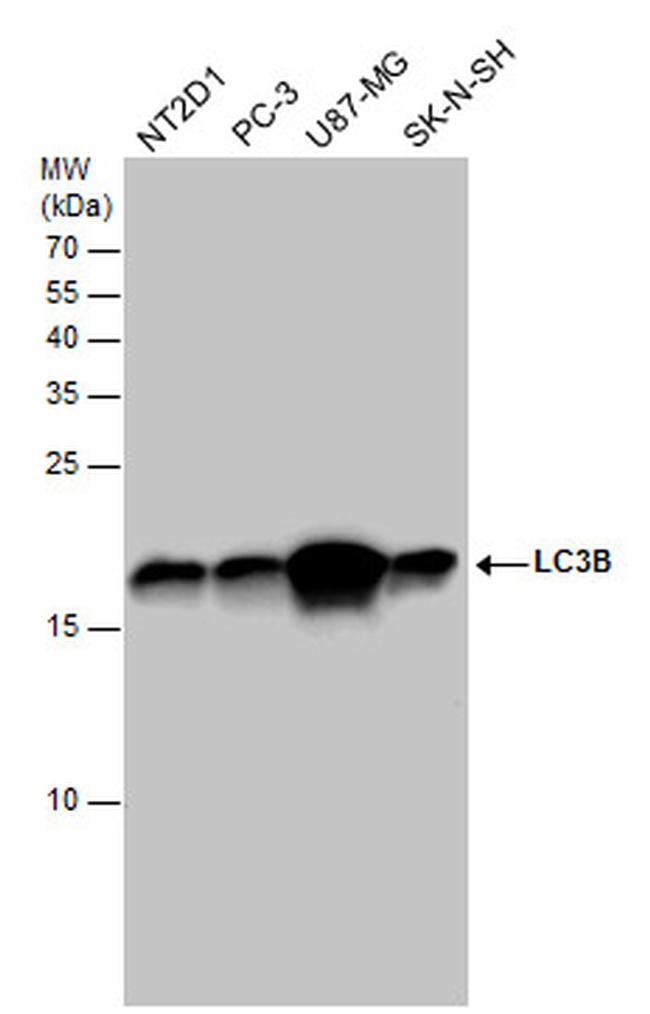 LC3B Antibody in Western Blot (WB)