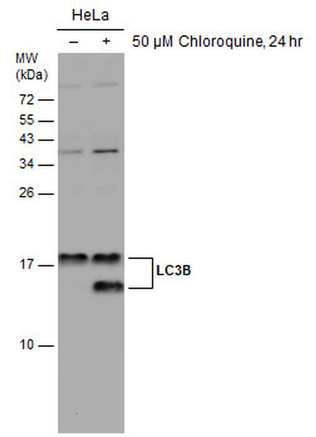 LC3B Antibody in Western Blot (WB)