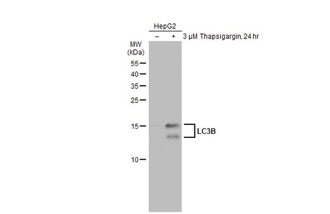 LC3B Antibody in Western Blot (WB)