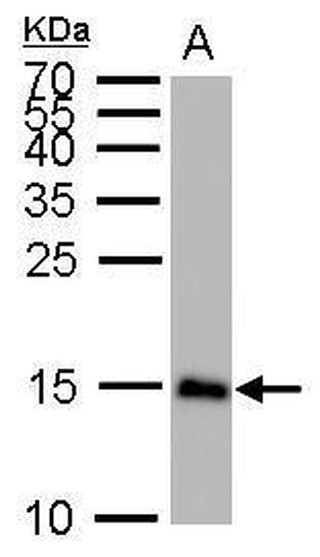 LC3B Antibody in Western Blot (WB)