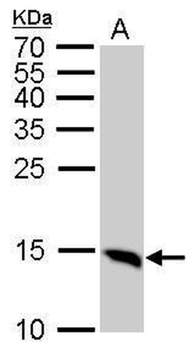 LC3B Antibody in Western Blot (WB)